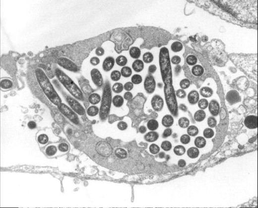 Cos’e  la legionella